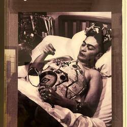 Always painting on her body casts after surgeries