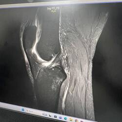 No picture of the delinquent goat, but of the insights of RidingKismet's knee.