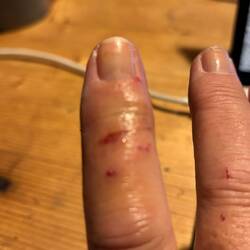 Autsch, autsch, autsch