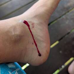 Das hört einfach nicht auf 🤷