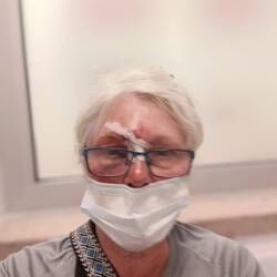 Net schoongemaakt en gehecht