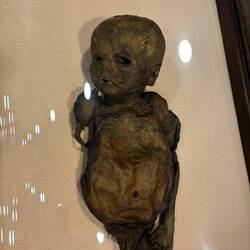 Mummia di un bambino