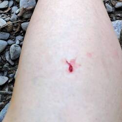 Da war er von meinem Bein schon abgefallen 🪱🪱