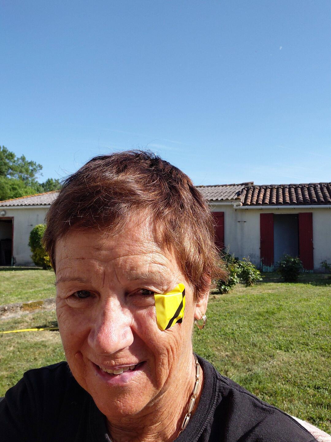 Yours truly and the anti venom Bee patch