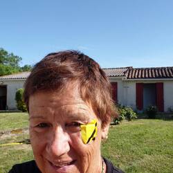 Yours truly and the anti venom Bee patch