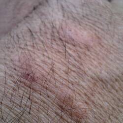 Midges und ich werden keine Freunde...
