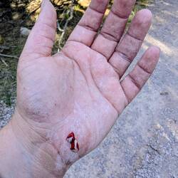 Little ouchie