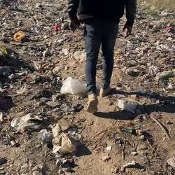 exposed fecal