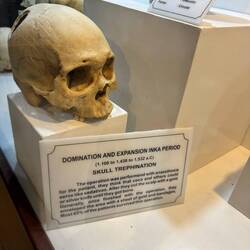 Evidence of Inca surgical skills