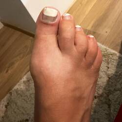 So sore