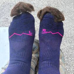 My toes have toupees. That's the hiking wool I shove in the shoes to protect my toes.
