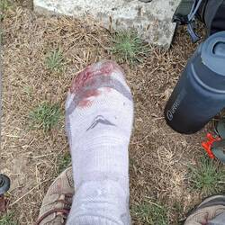 NOT what you want to see when you take off your shoe!!!