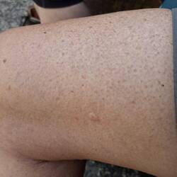 While waiting to check in at 1pm I got stung by a wasp!
