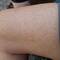 While waiting to check in at 1pm I got stung by a wasp!
