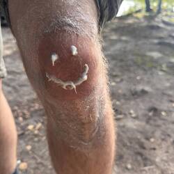 Das Knie braucht etwas Unterstützung