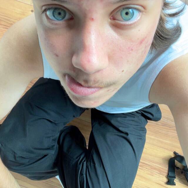 Lui Pieles