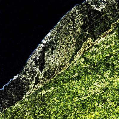 Ischgel